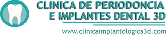 Clínica Implantologica 3D